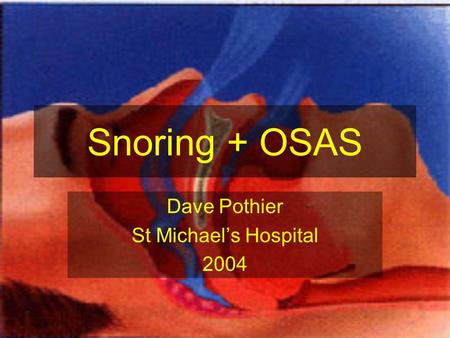 Snoring + OSAS Dave Pothier St Michael’s Hospital 2004.