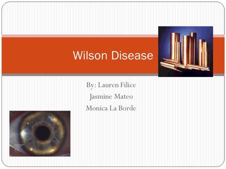 By: Lauren Filice Jasmine Mateo Monica La Borde Wilson Disease.
