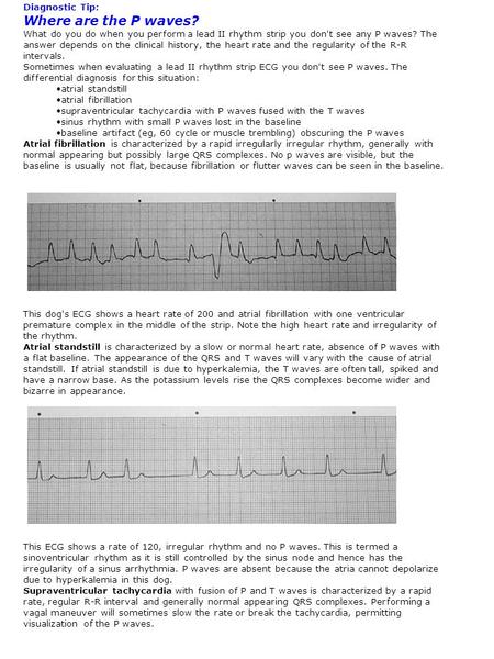 Diagnostic Tip: Where are the P waves? What do you do when you perform a lead II rhythm strip you don't see any P waves? The answer depends on the clinical.