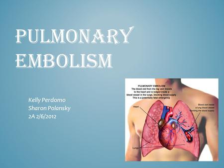 PULMONARY EMBOLISM Kelly Perdomo Sharon Polansky 2A 2/6/2012.