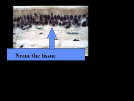 Name the tissue. Ciliated pseudostratified columnar epithelium.