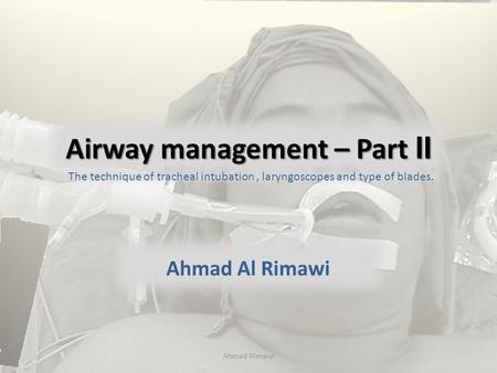 Airway management – Part II Ahmad Al Rimawi The technique of tracheal intubation, laryngoscopes and type of blades. Ahmad Rimawi.