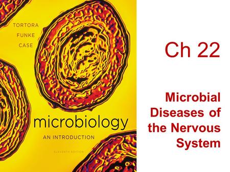 Ch 22 Microbial Diseases of the Nervous System.