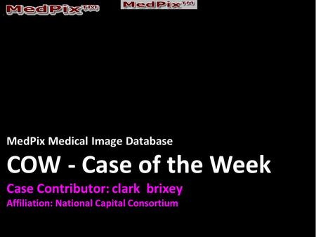MedPix Medical Image Database COW - Case of the Week Case Contributor: clark brixey Affiliation: National Capital Consortium.