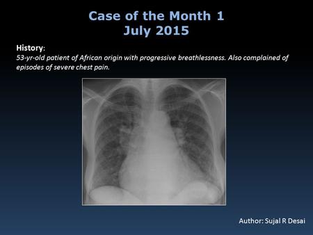 History : 53-yr-old patient of African origin with progressive breathlessness. Also complained of episodes of severe chest pain. Case of the Month 1 July.