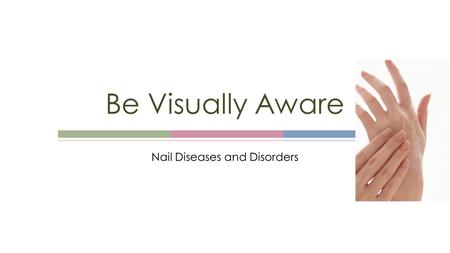 Nail Diseases and Disorders Be Visually Aware. Copyright Copyright © Texas Education Agency, 2013. These Materials are copyrighted © and trademarked ™