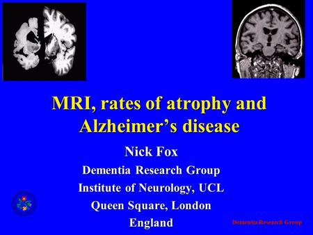 Dementia Research Group MRI, rates of atrophy and Alzheimer’s disease Nick Fox Dementia Research Group Institute of Neurology, UCL Queen Square, London.