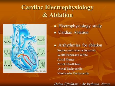 Cardiac Electrophysiology & Ablation