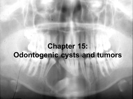 Chapter 15: Odontogenic cysts and tumors