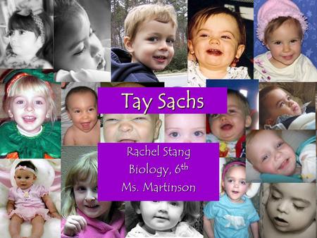 Tay Sachs Rachel Stang Biology, 6 th Ms. Martinson.