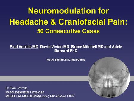 Neuromodulation for Headache & Craniofacial Pain: 50 Consecutive Cases Paul Verrills MD, David Vivian MD, Bruce Mitchell MD and Adele Barnard PhD Metro.