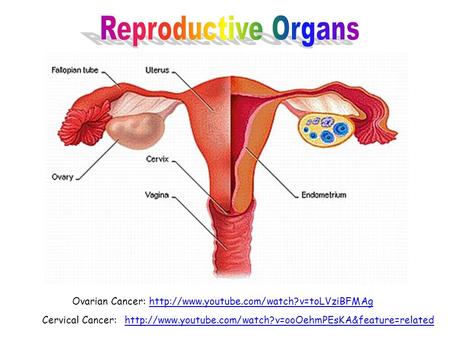 Ovarian Cancer:  Cervical Cancer:http://www.youtube.com/watch?v=ooOehmPEsKA&feature=related.