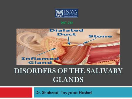 Disorders of the salivary glands