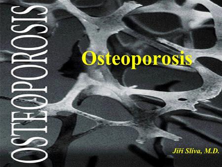 Osteoporosis Jiří Slíva, M.D.. Osteoporosis §a bone disease that is characterized by progressive loss of bone density and thinning of bone tissue §higher.