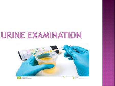  Usually done on the mid stream urine  Fresh voided urine  The container is clean and sterile (for culture )  The sample must be tested within 1hr.