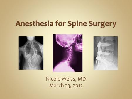Nicole Weiss, MD March 23, 2012. Neuromonitoring &/or Wake-Up Test Significant Blood Loss Requiring Transfusion Postoperative Vision Loss Spinal Trauma-