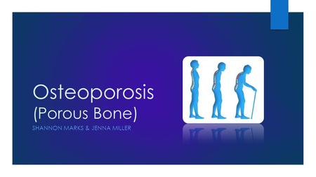 Osteoporosis (Porous Bone)