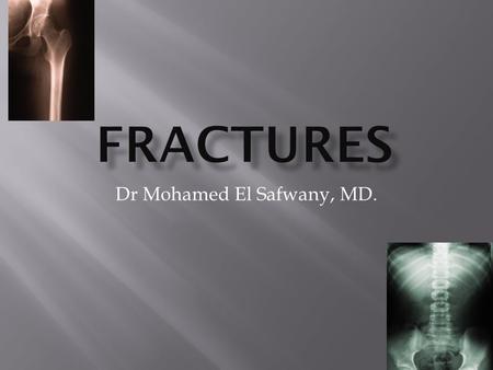 Dr Mohamed El Safwany, MD..  The student should be able at the end of this lecture to recognize various radiographic principles of fractures.