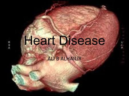 Heart Disease ALI B ALHAILIY. Cardiovascular disease refers to any disease that affects the cardiovascular system. The causes of cardiovascular disease.