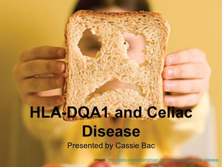 HLA-DQA1 and Celiac Disease Presented by Cassie Bac Image:  insightshttp://www.scientificamerican.com/article.cfm?id=celiac-disease-