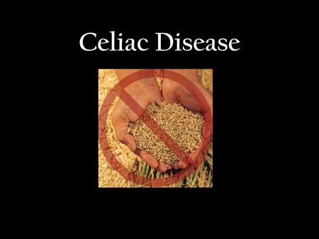 Celiac Disease. Recent Prevalence of Celiac Disease 1 in 133 people have CD Prevalent, but under diagnosed – Those not diagnosed have a higher death rate.