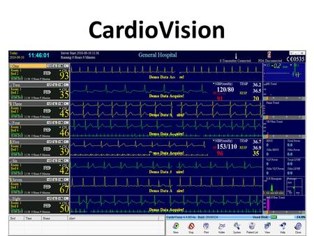CardioVision. CardioVision = Hospital Monitoring + Holter ECG….....