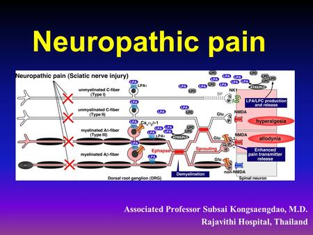 Neuropathic pain. Types of Pain Nociceptive Pain An appropriate Physiologic response to painful stimuli Neuropathic Pain An inappropriate response caused.