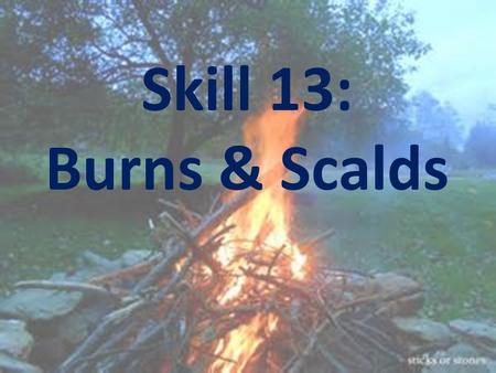 Skill 13: Burns & Scalds. Learning Intention: To equip you with the knowledge to avoid, recognise and treat burns and scalds.