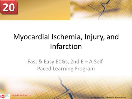 Myocardial Ischemia, Injury, and Infarction