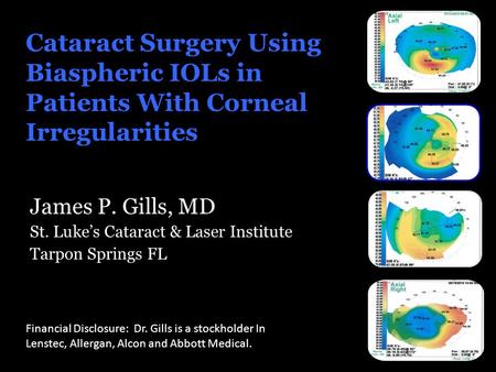 Cataract Surgery Using Biaspheric IOLs in Patients With Corneal Irregularities James P. Gills, MD St. Luke’s Cataract & Laser Institute Tarpon Springs.