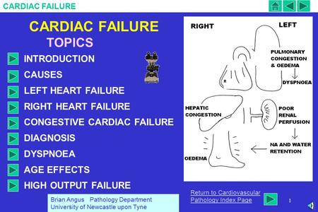CARDIAC FAILURE 1 TOPICS INTRODUCTION CAUSES LEFT HEART FAILURE RIGHT HEART FAILURE CONGESTIVE CARDIAC FAILURE DIAGNOSIS DYSPNOEA AGE EFFECTS HIGH OUTPUT.