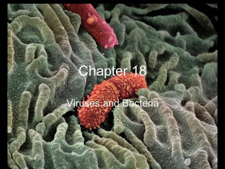 Chapter 18 Viruses and Bacteria. Viruses, bacteria, viroids, and prions can all cause infection or disease Eukaryotic cells 10,000-100,000 nm Prokaryotic.