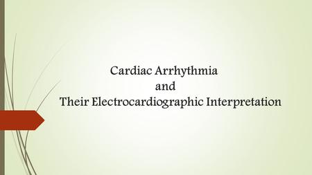 Cardiac Arrhythmia and Their Electrocardiographic Interpretation