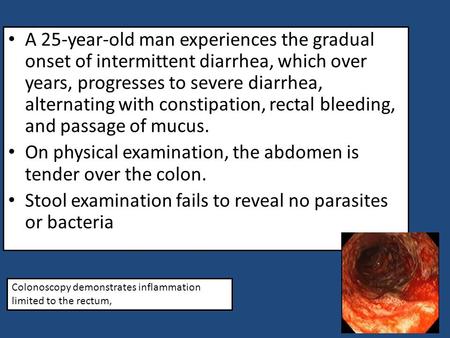 On physical examination, the abdomen is tender over the colon.