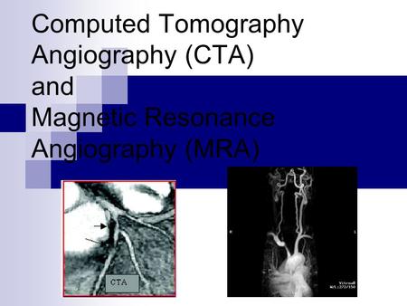 What Are They? Computed Tomography Angiography (CTA)