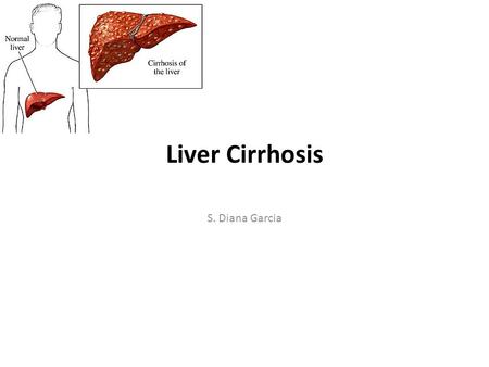 Liver Cirrhosis S. Diana Garcia