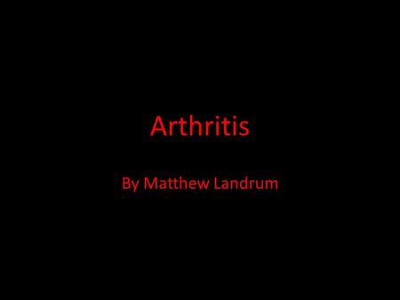 Arthritis By Matthew Landrum. Ice!! I would like you to put your hand in the bag of ice until the end of my presentation to simulate not being able to.