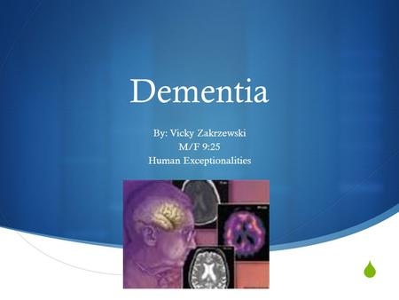  Dementia By: Vicky Zakrzewski M/F 9:25 Human Exceptionalities.