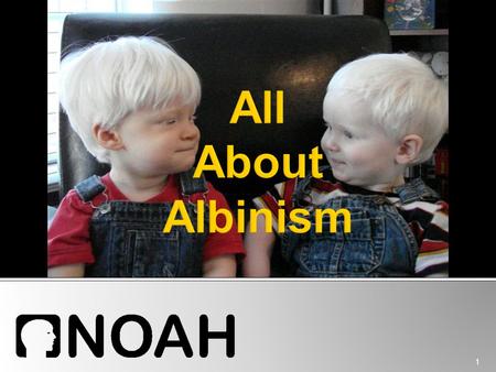 All About Albinism.