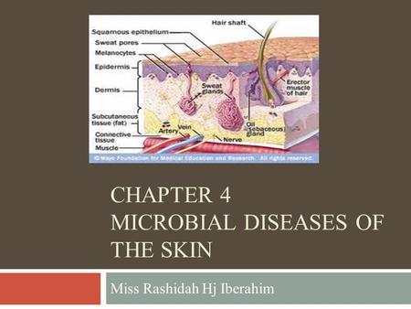 CHAPTER 4 MICROBIAL DISEASES OF THE SKIN Miss Rashidah Hj Iberahim.