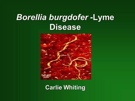Borellia burgdofer -Lyme Disease Carlie Whiting. Lyme Disease What Is lyme Disease? What Is lyme Disease? Signs and Symptoms Signs and Symptoms Stages.