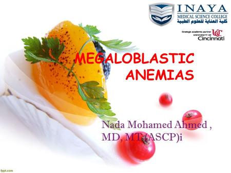 MEGALOBLASTIC ANEMIAS Nada Mohamed Ahmed, MD, MT (ASCP)i.