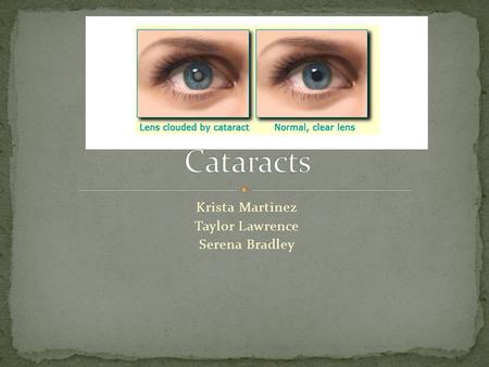 Krista Martinez Taylor Lawrence Serena Bradley.  A cataract is a clouding of your lens in your eye(s) that can cause impaired vision.  More than half.