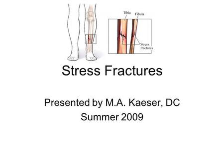 Stress Fractures Presented by M.A. Kaeser, DC Summer 2009.