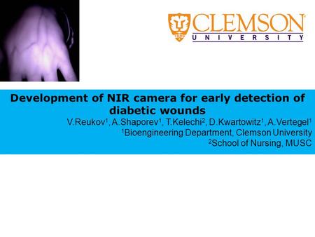 Development of NIR camera for early detection of diabetic wounds V.Reukov 1, A.Shaporev 1, T.Kelechi 2, D.Kwartowitz 1, A.Vertegel 1 1 Bioengineering Department,