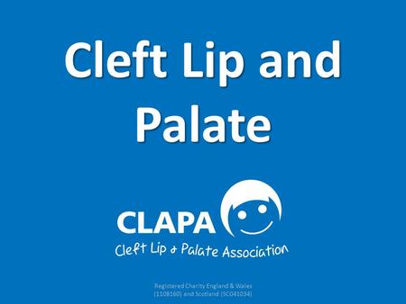 Registered Charity England & Wales (1108160) and Scotland (SC041034) Cleft Lip and Palate.