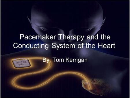 Pacemaker Therapy and the Conducting System of the Heart By: Tom Kerrigan.