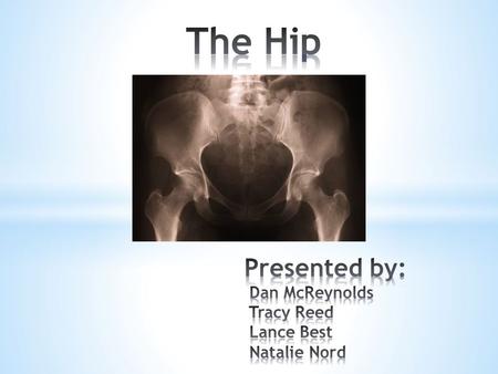 The Hip Presented by: Dan McReynolds Tracy Reed Lance Best