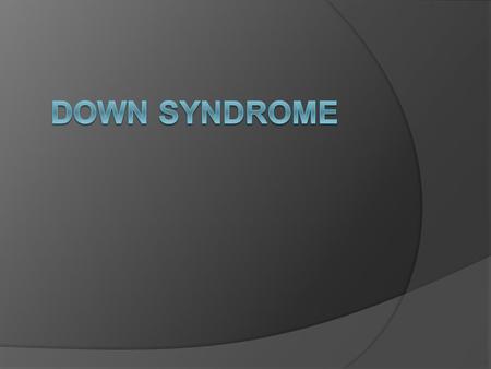Down syndrome.