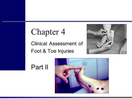 Clinical Assessment of Foot & Toe Injuries Part II